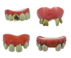 DENTIERA DRACULA SPIRITOSA MODELLABILI